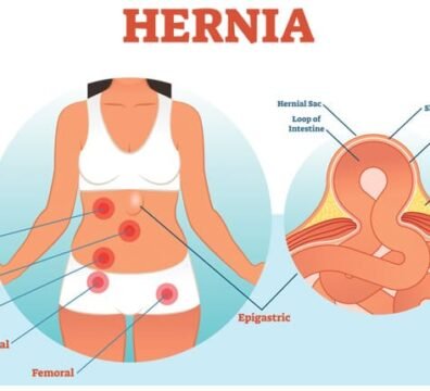 Dr Durai Ravi Hernia Surgeon