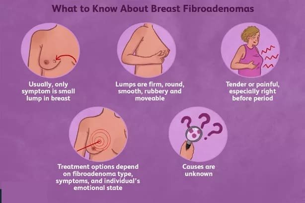 Know about the causes of Breast Lump