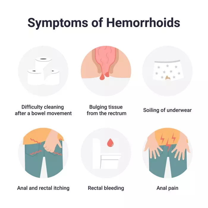 Symptoms for Hemorrhoids