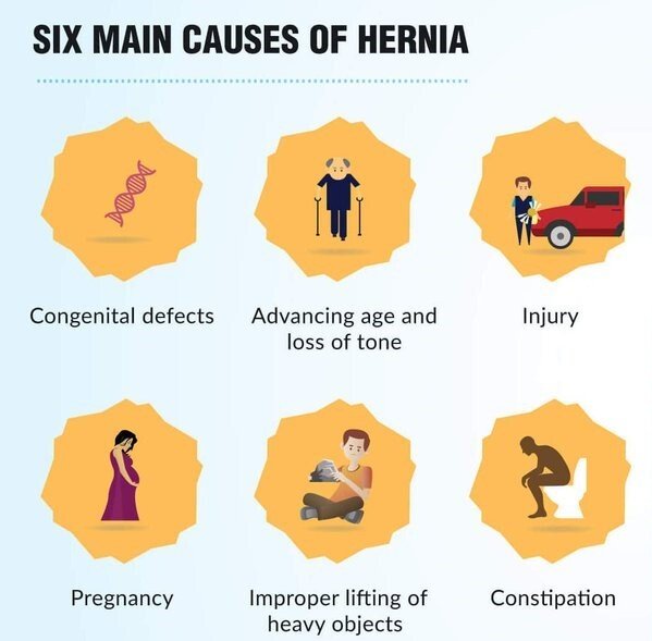Causes for Hernia