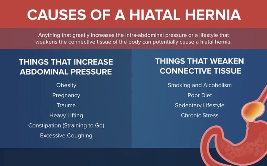 Causes of Hiatus-Hernia