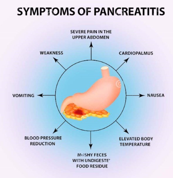 Symptoms of Pancreatitis