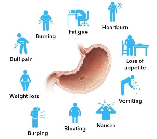 Symptoms for Ulcer Disease