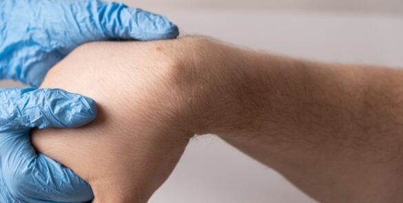 Lipoma Vs Cancer Lump Signs And Symptoms
